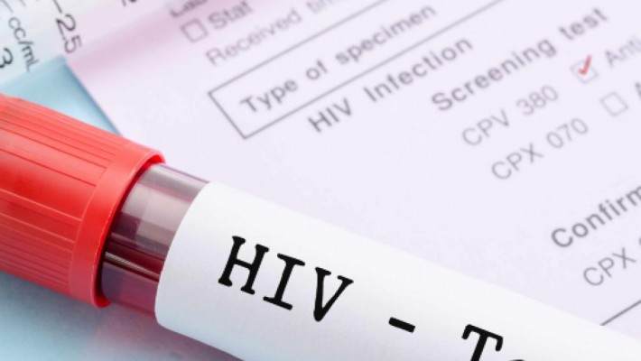 Un efficace trattamento dell’HIV: eliminata la trasmissione sessuale Un efficace trattamento dell’HIV: eliminata la trasmissione sessuale