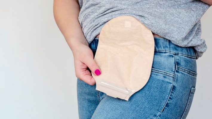 Come la cistectomia e la derivazione urinaria potrebbero influenzare la funzione sessuale femminile e l’immagine corporea? Come la cistectomia e la derivazione urinaria potrebbero influenzare la funzione sessuale femminile e l’immagine corporea?